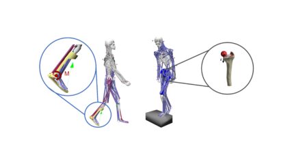 Specific examples of the KTmfk for the application of musculoskeletal multi-body simulation in the orthopaedic field